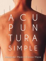 Acupuntura Simple
