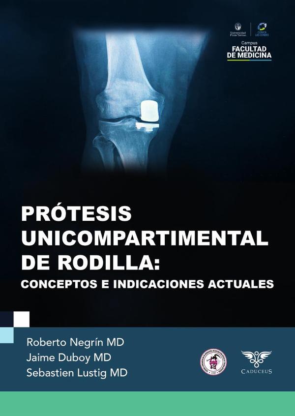 Prótesis unicompartimental de rodilla:Conceptos e indicaciones actuales