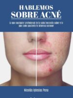 Hablemos sobre acné