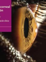 Topografía corneal por elevación mediante Pentacam®:Análisis e interpretación clínica