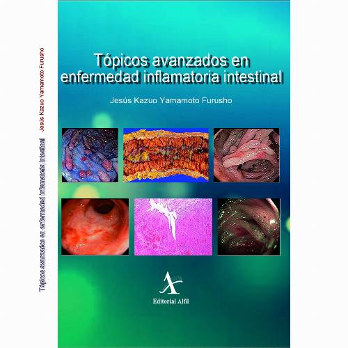 Tópicos avanzados en enfermedad inflamatoria intestinal