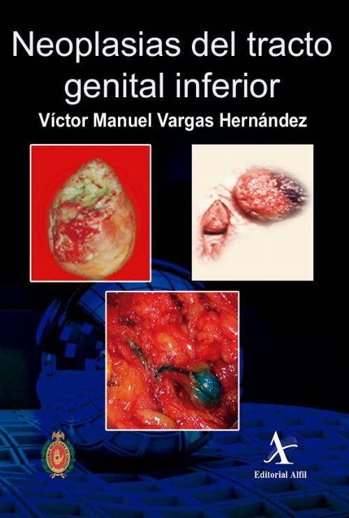Neoplasias del tracto genital inferior