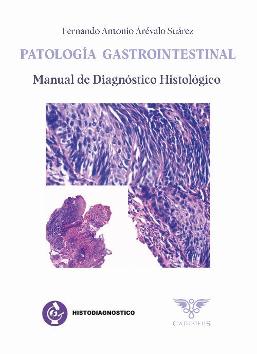 Histodiagnóstico. Patología gastrointestinal