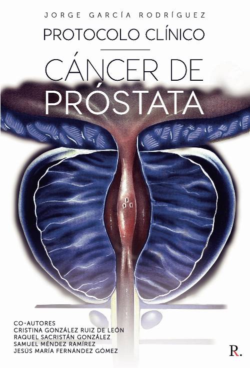 Protocolo clínico cáncer de próstata