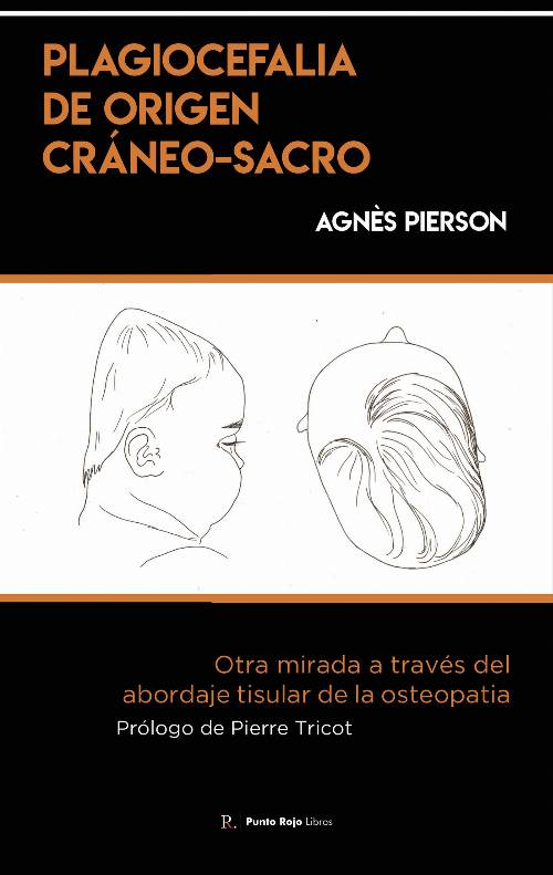 Plagiocefalia de origen cráneo-sacro