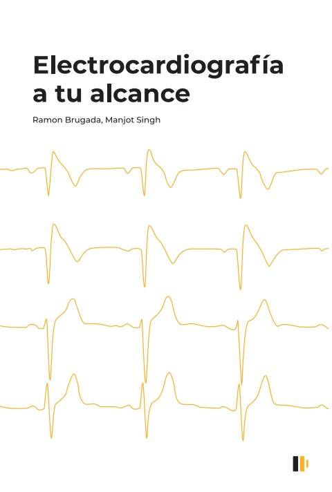 Electrocardiografía a tu alcance