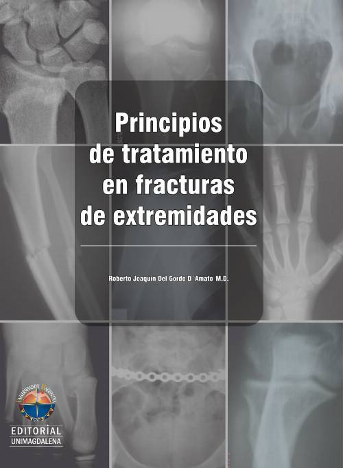 Principios de tratamiento en fracturas de extremidades