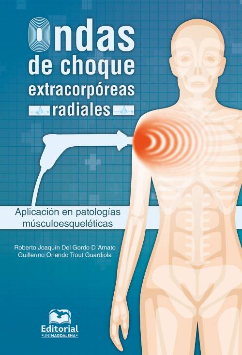 Ondas de choque extracorpóreas radiales