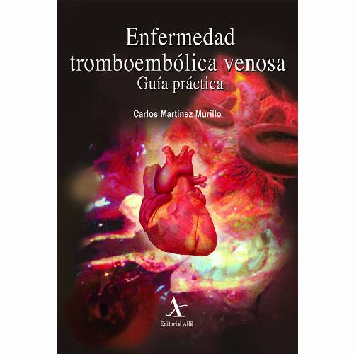 Enfermedad tromboembólica venosa. Guía práctica