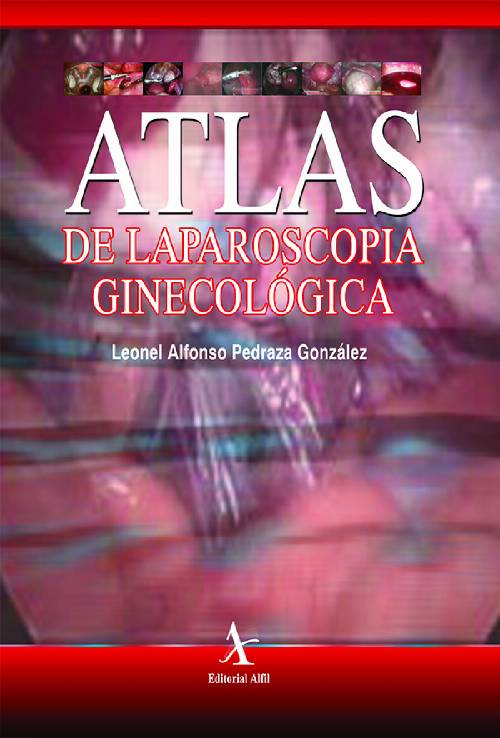 Atlas de laparoscopia ginecológica